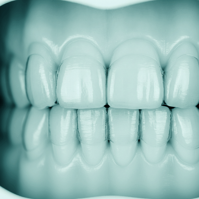 Aligners — straightened quietly